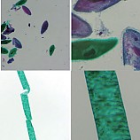짚신벌레해캄프레파라트/영구프레파라트/2종1조