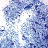 신경세포영구표본/영구프레파라트Carolina 1장